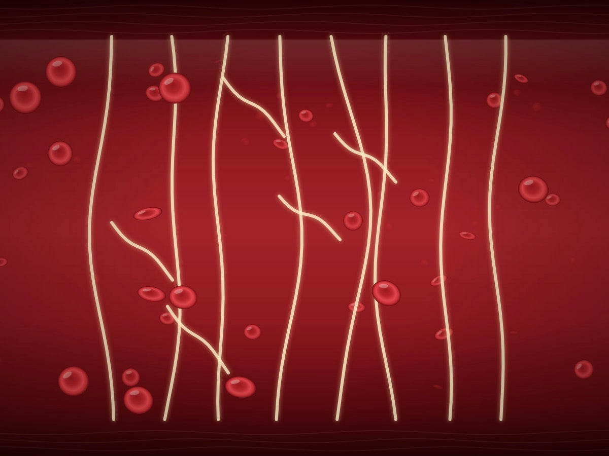 Illustration of a dense fibrin mesh in a blood vessel
