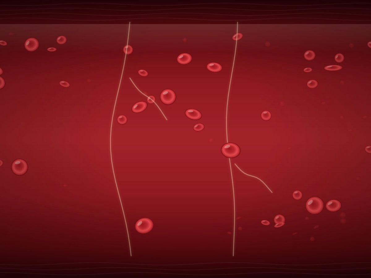 Illustration of a few fibrin strands in a blood vessel